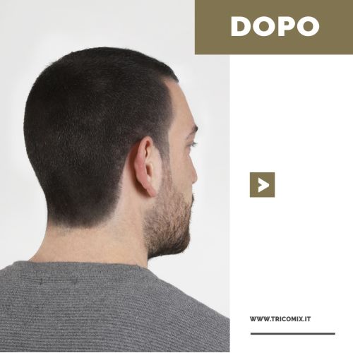 Fibre di Cheratina Volumizzanti Contro il...